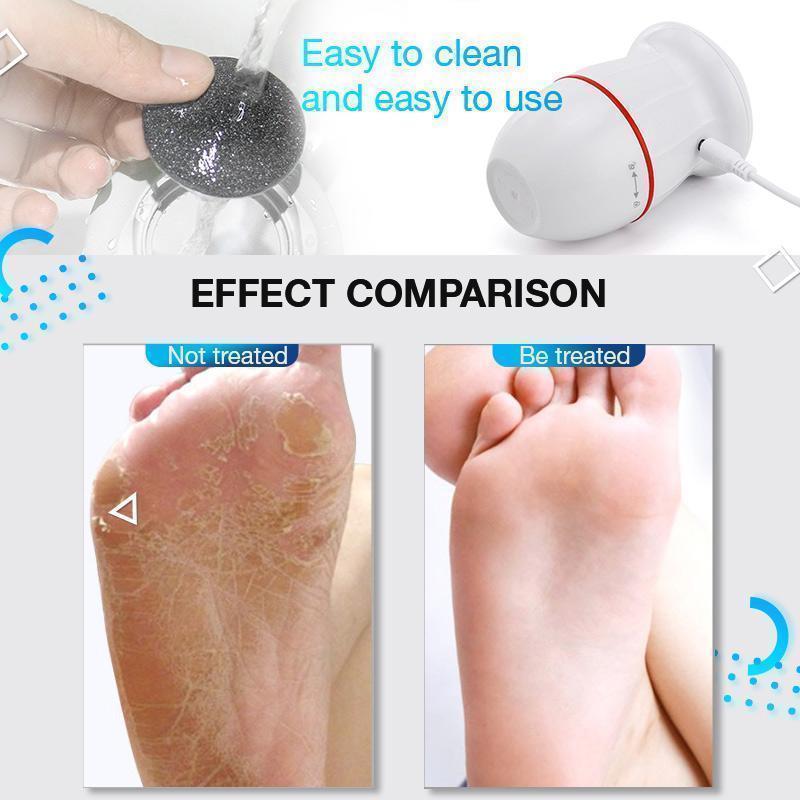 (image for) USB Rechargeable Vacuum Adsorption Foot Grinder