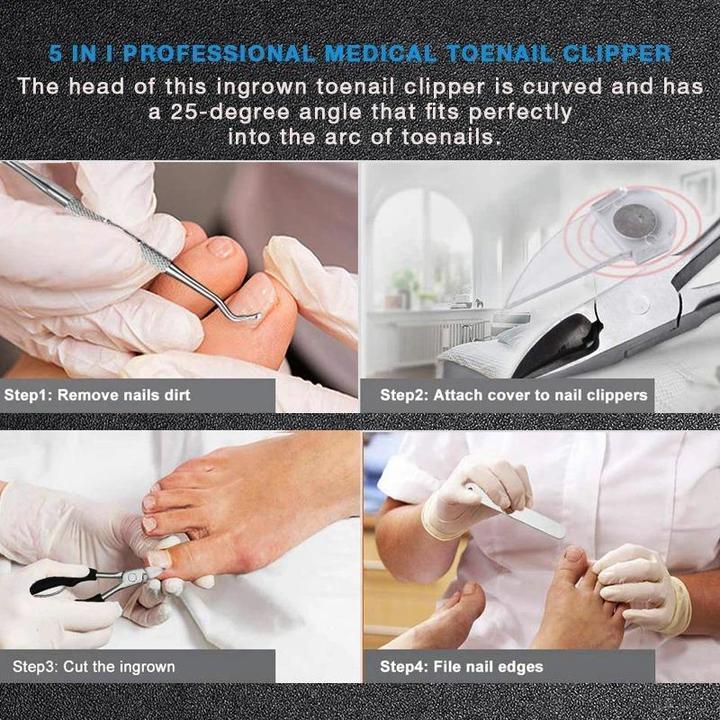 (image for) Medical-Grade Nail Clippers