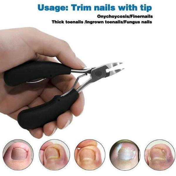 (image for) Medical-Grade Nail Clippers